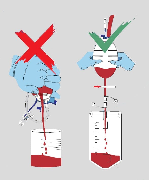 reservoir bulbs safety - redax