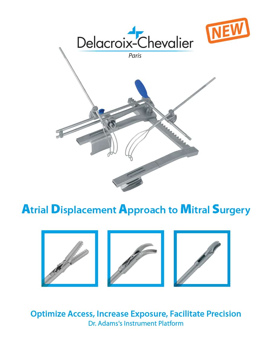 Delacroix-Chevalier Atrial Displacement Approach to Mitral Surgery Showcasing Dr. Adam's Instrument Platform