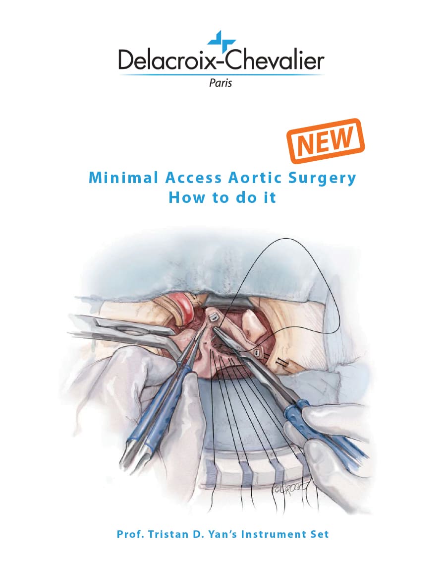 Delacroix-Chevalier Minimal Access Aortic Surgery Catalog Showcasing Prof Tristan Yan's Complex AO Surgical Platform